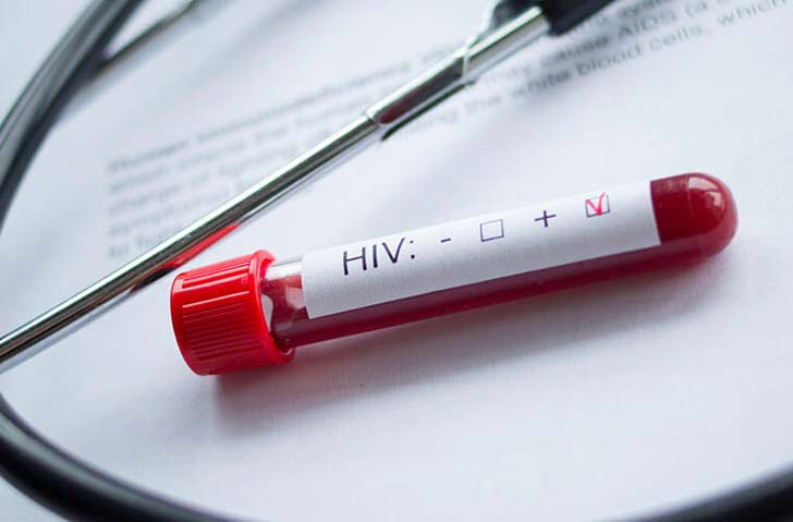 HIV Screening