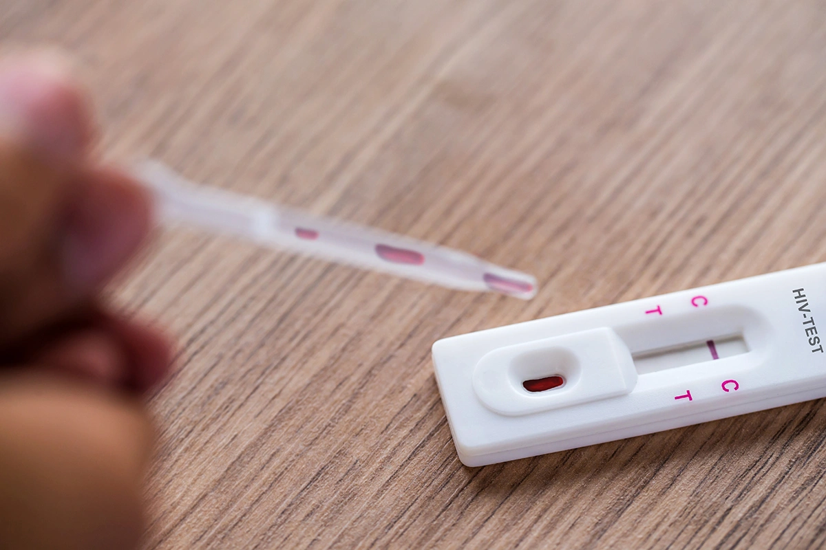 What’s the Difference Between STD Testing and HIV Testing?