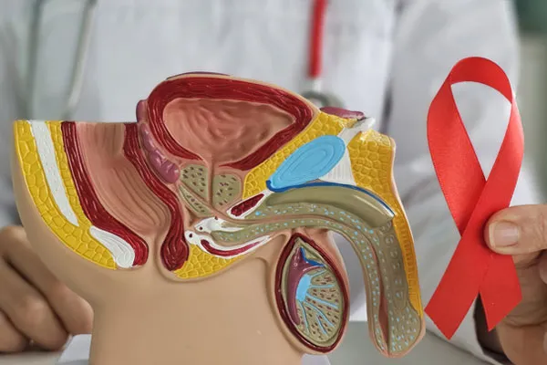 What Are the Early Signs and Symptoms of HIV in Men?