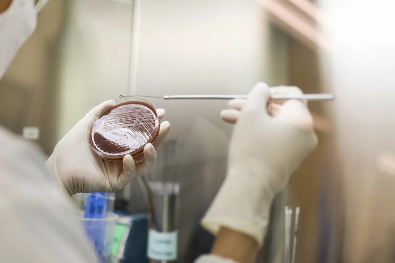What Happens If You Test Positive for Gonorrhoea?