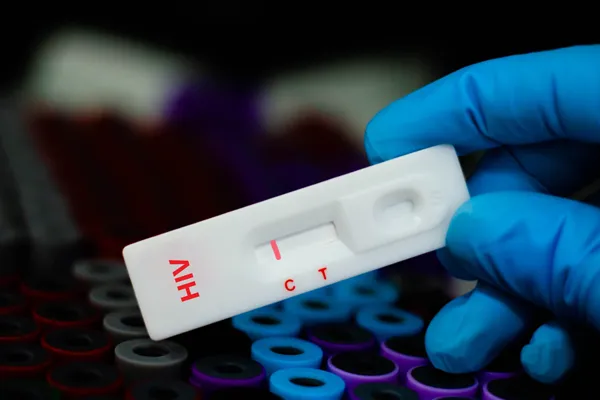 HIV Testing Explained: When Should Men Get Tested?